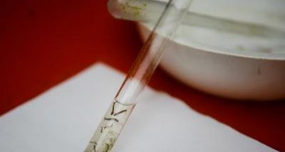 Colômbia registra mais de 37 mil vítimas do vírus Zika