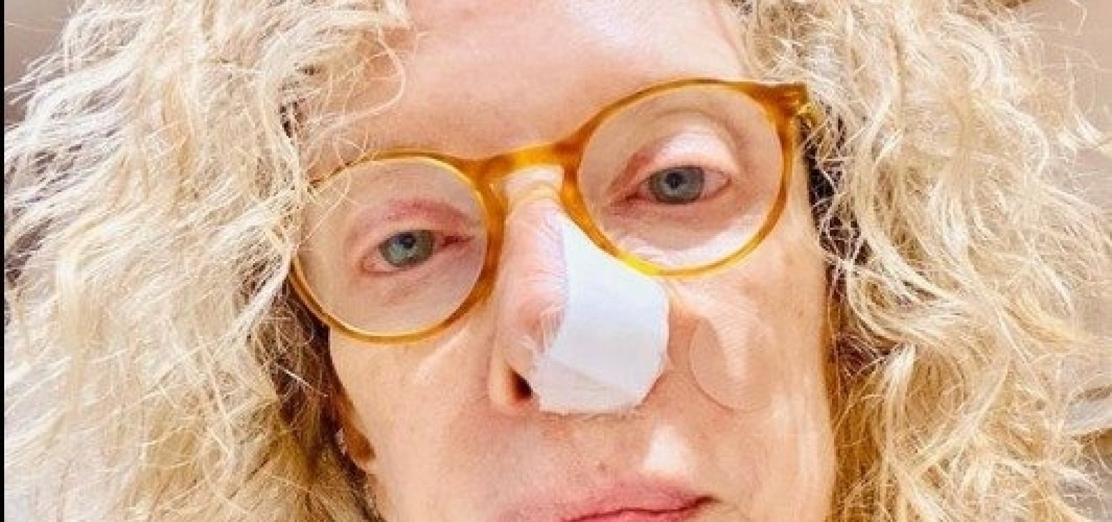 [Marília Gabriela passa por cirurgia depois de descobrir câncer no nariz ]