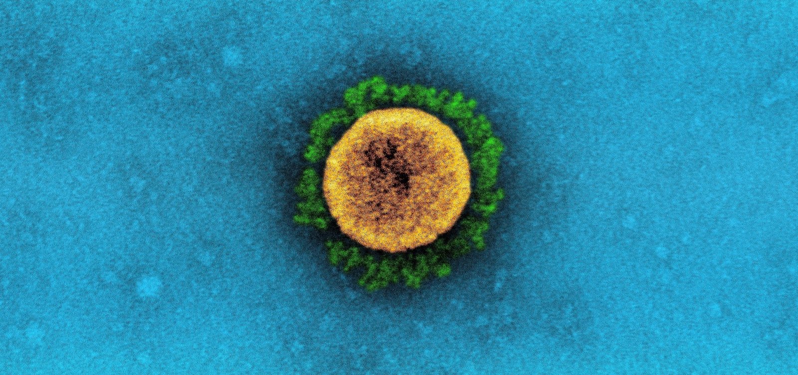 [Uruguai confirma detecção de variantes brasileiras do novo coronavírus]