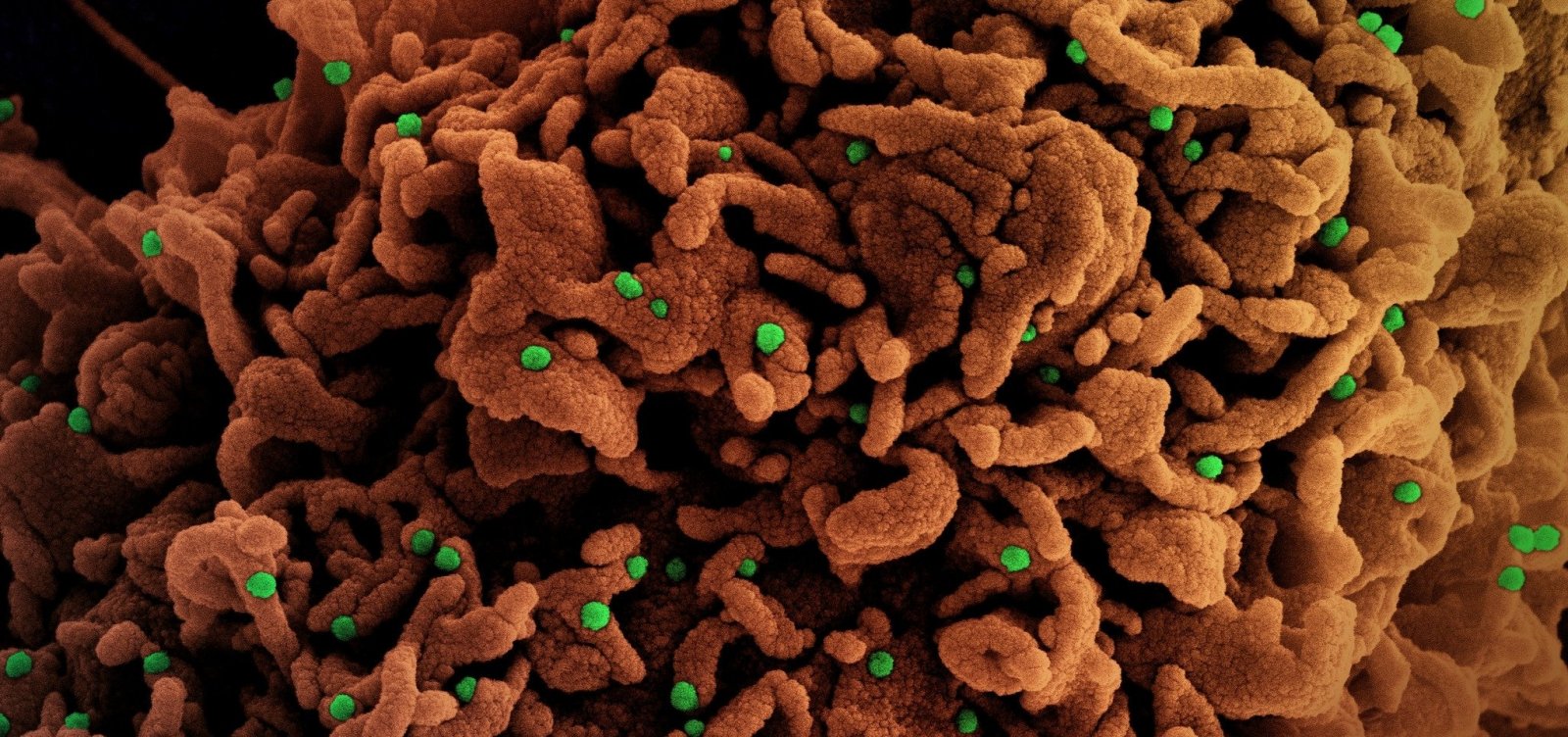 [Fiocruz detecta novas mutações em variantes do coronavírus no Brasil]