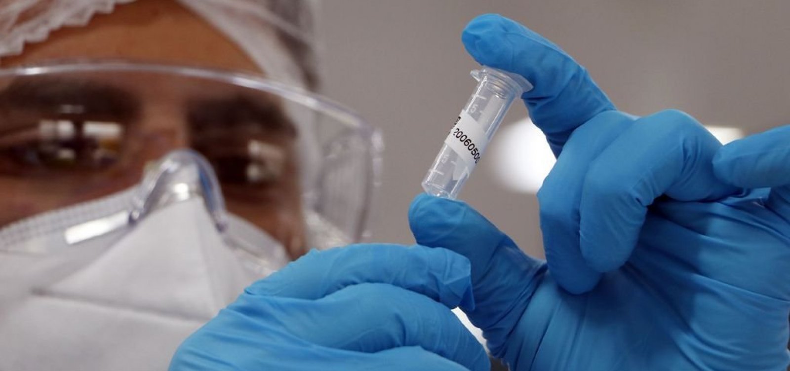 [Bahia registra mais 160 mortes, e tem novo recorde de &oacute;bitos por Covid-19 em 24h]