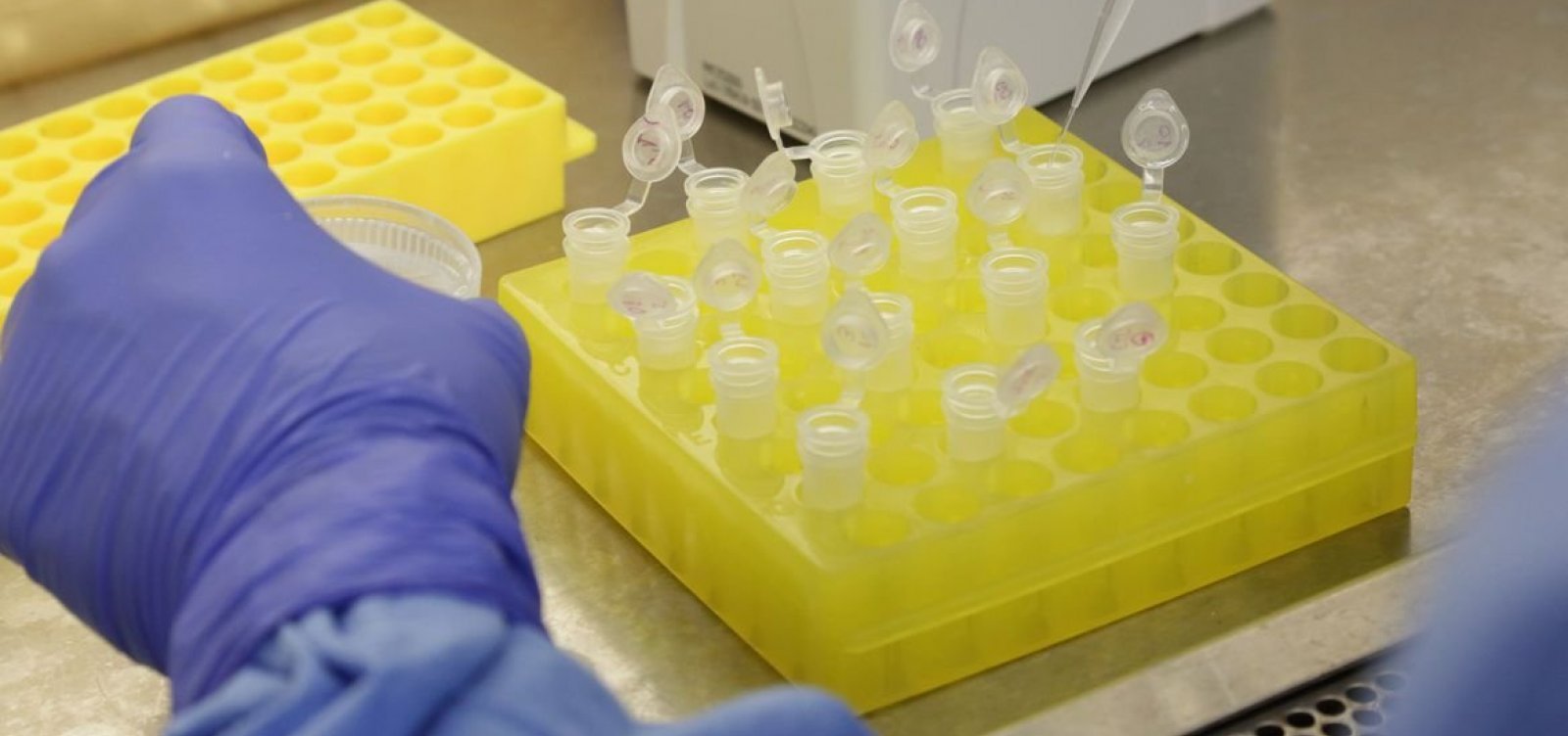 [OMS vê 'situação crítica' no Brasil com variante mais transmissível ]