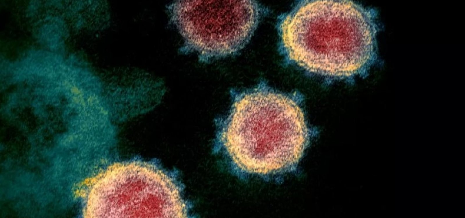 [Sem ivermectina e cloroquina, Anvisa autoriza uso de coquetel de rem&eacute;dios para combater covid-19]