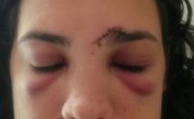 Mulher é agredida depois de [Mulher é agredida depois de