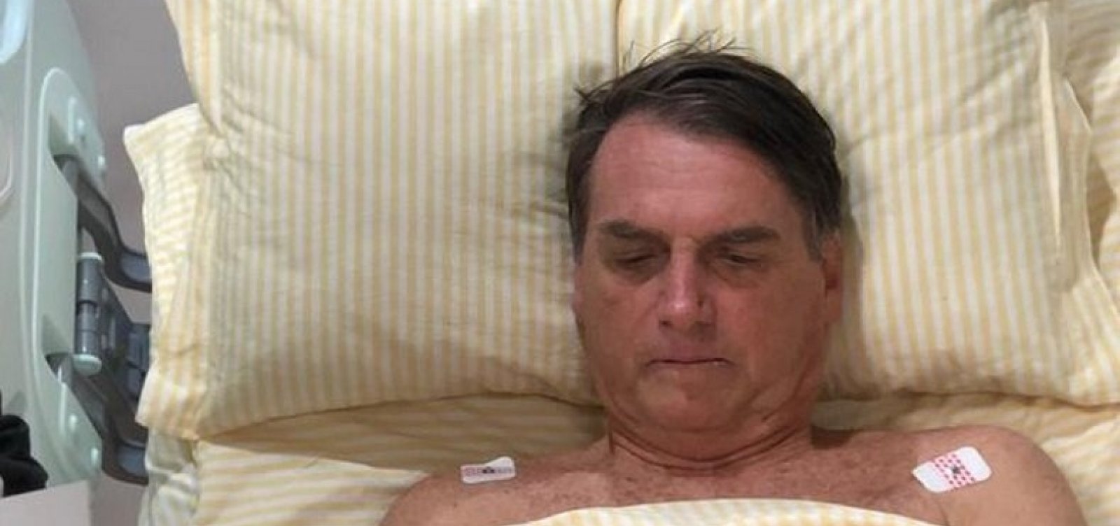 [Bolsonaro passa mal e se alimenta através de sonda]