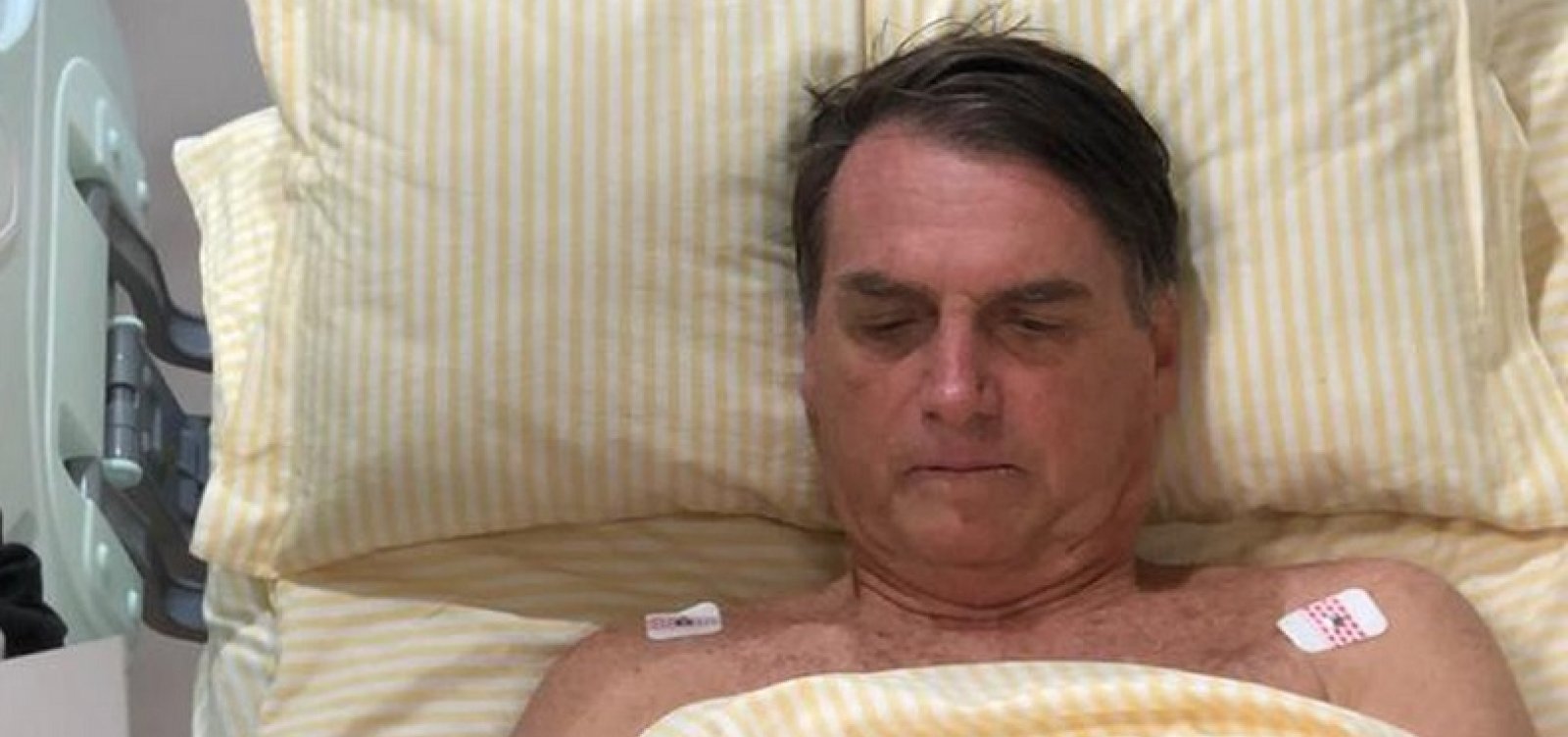 [Bolsonaro tem aval de equipe médica para ter alta nesta quarta]
