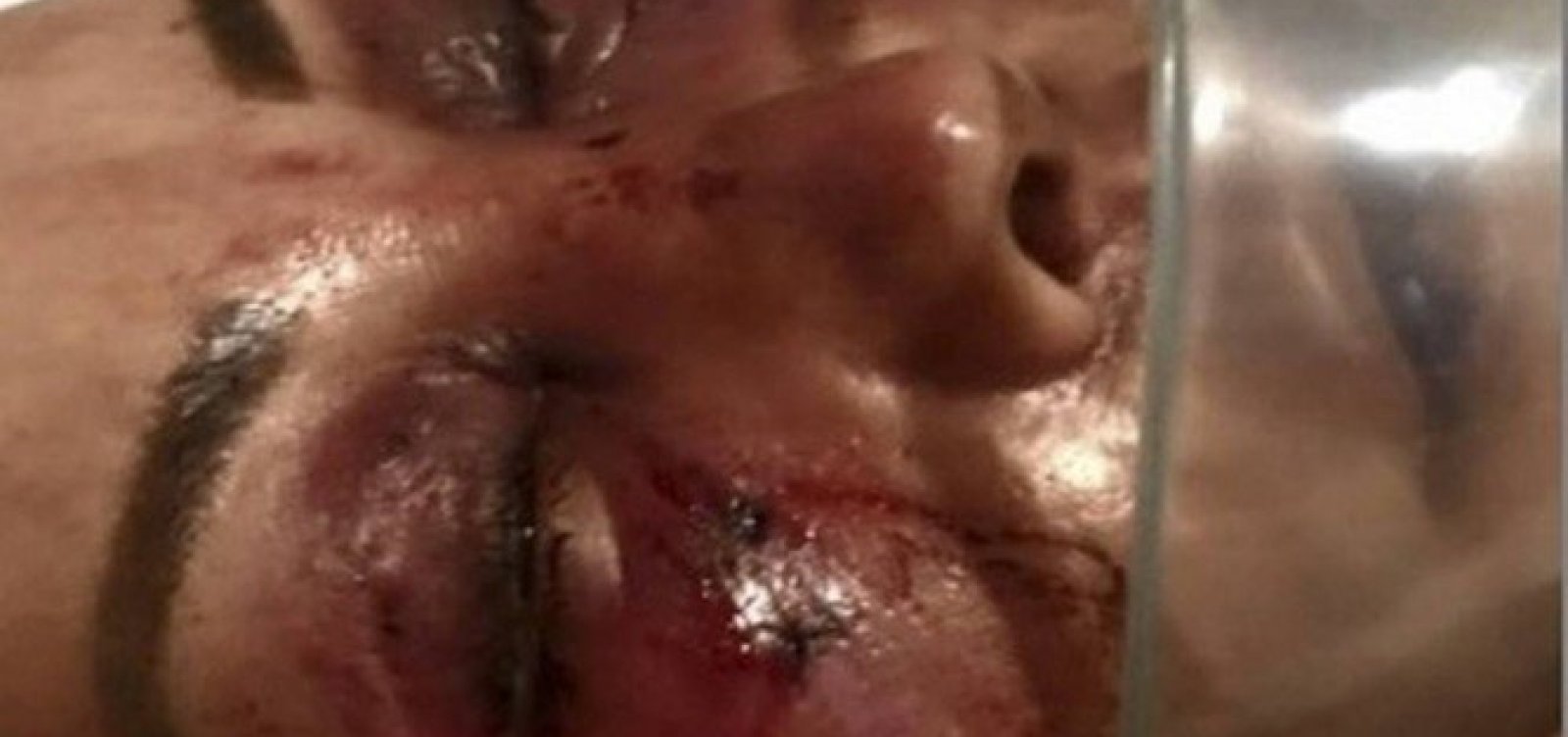 [Mulher é espancada por quase quatro horas no Rio]