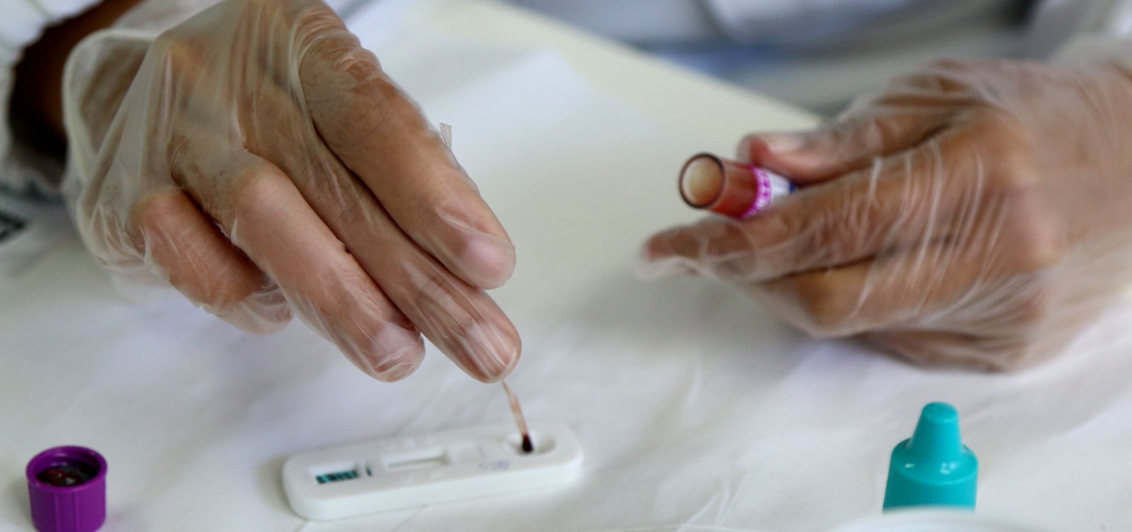 [Mais de 190 casos positivos para DSTs foram detectados no Carnaval]