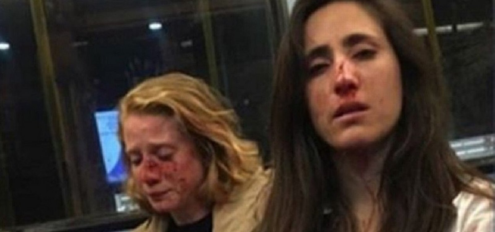 [Casal lésbico é agredido em Londres após negar beijo]