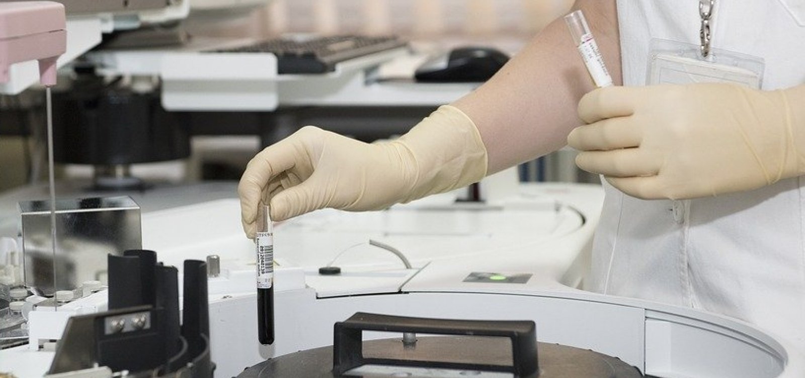 [Diagnóstico tardio de câncer de pulmão acontece em 86% dos casos]