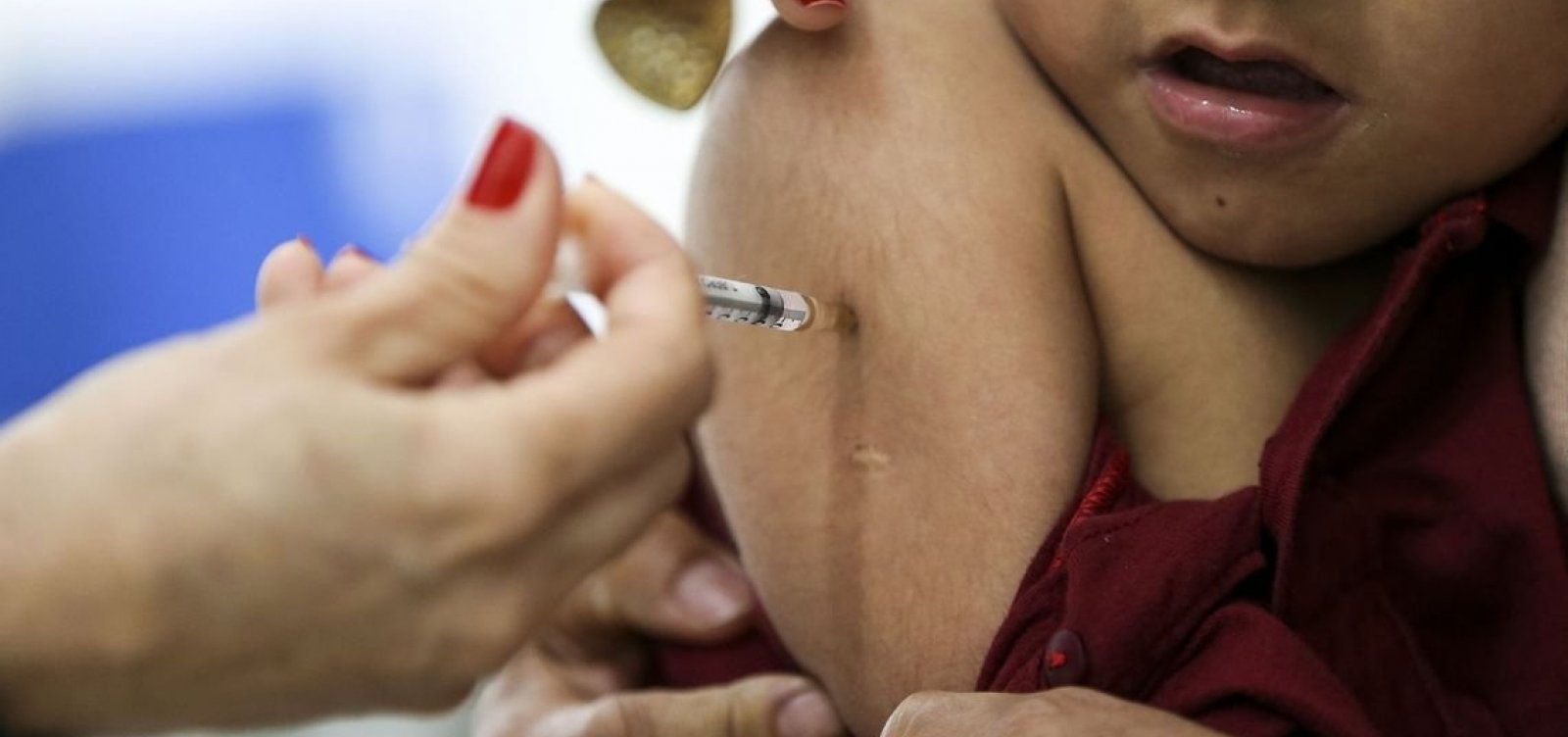 [MinistÃ©rio da SaÃºde aumenta nÃ­vel de alerta para sarampo]