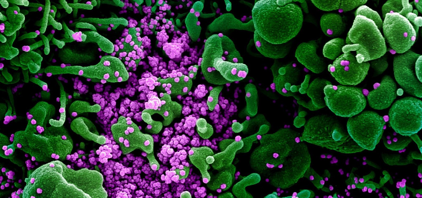 [Pela 1ª vez, China anuncia que não registrou novas infecções locais do novo coronavírus]