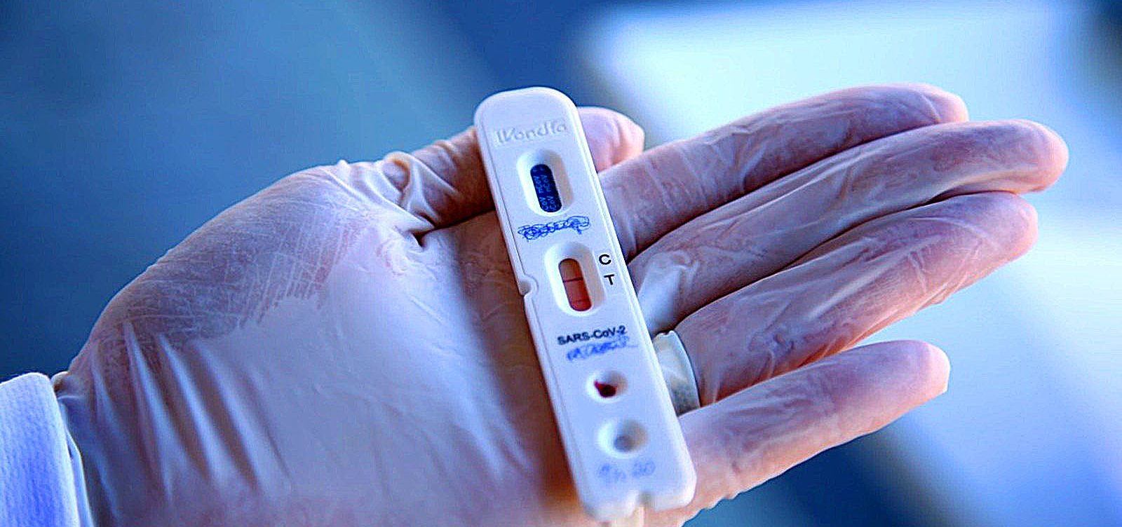 [Governo destina R$ 10 bilhões para ações contra covid-19]