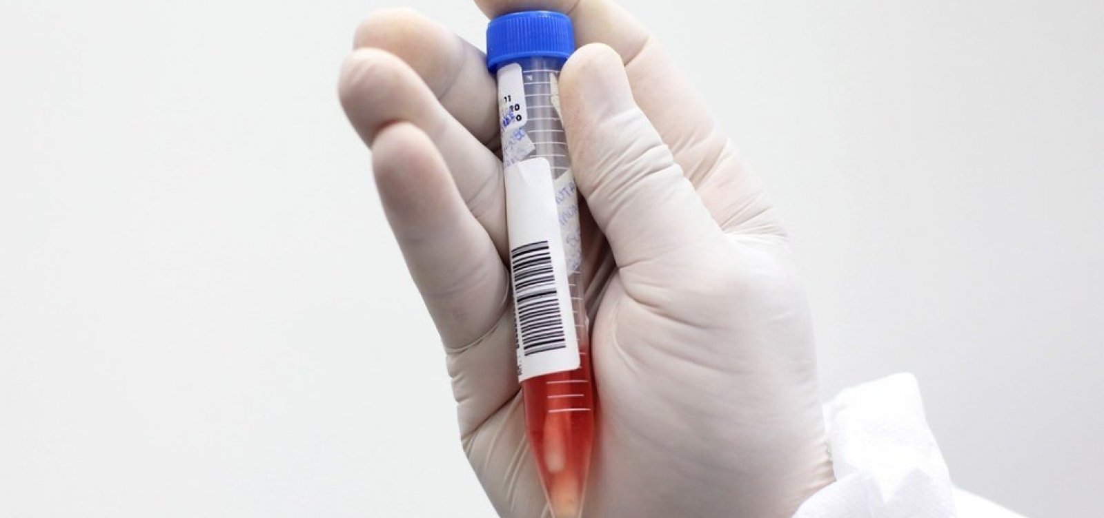 [Coronavírus: Bahia alcança 13 mil casos e 400 mortes ]