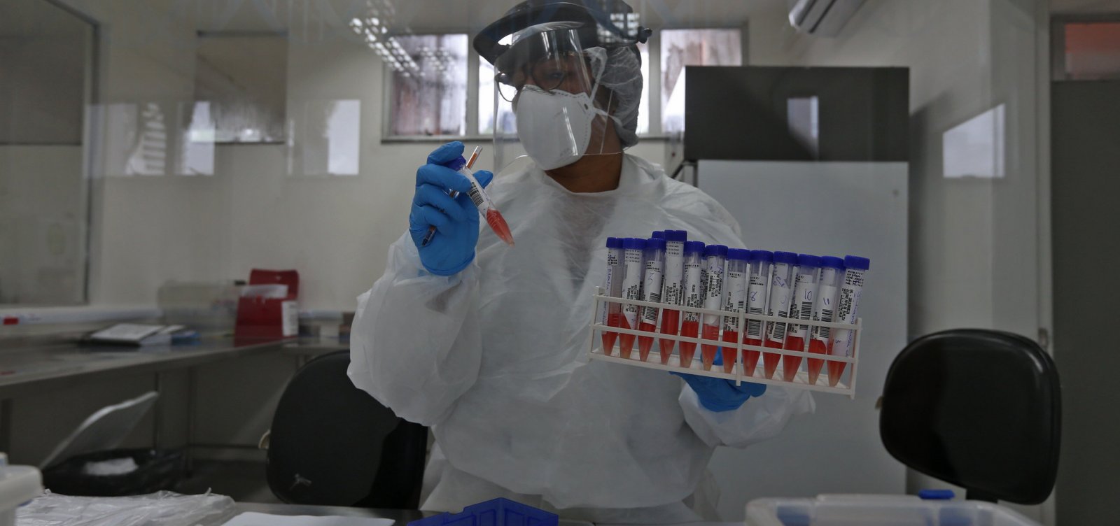 [Anvisa autoriza retomada de testes da CoronaVac]